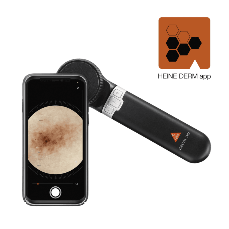 Csm K 000.00.001 Heine Dermatoscope Derm App Delta 30 En Gb Additional 1f44c05a6b Csm K 000.00.001 Heine Dermatoscope Derm App Delta 30 En Gb Additional 1f44c05a6b