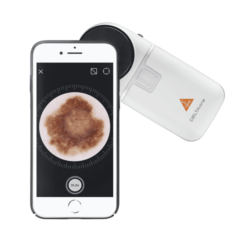 Csm K 211.28.305 Heine Dermatoscope Deltaone White Edition Additional5 05db463323 Csm K 211.28.305 Heine Dermatoscope Deltaone White Edition Additional5 05db463323