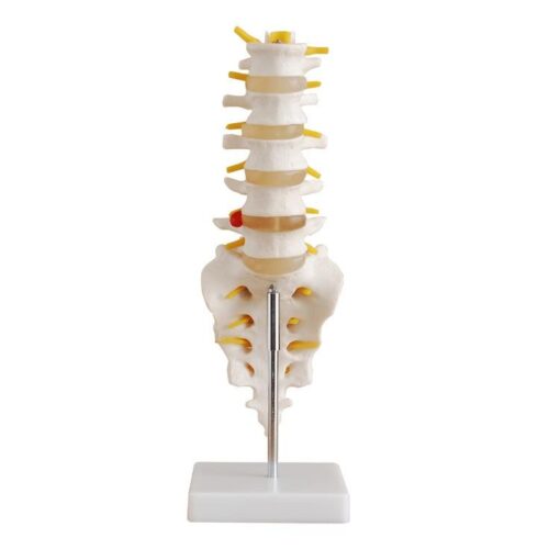 LUMBAR VERTEARAE WITH SACRUM & COCCYX AND HEARINATED DISC LIFE SIZE