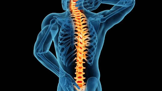 What Is Spinal Stenosis: Symptoms, Causes & Diagnosis