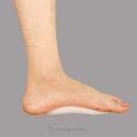 Medial Arch Support (Pair) - Flamingo (2)
