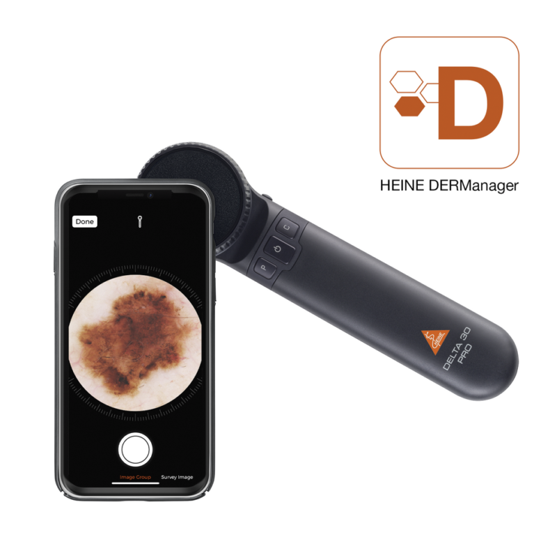 csm_K-235.28.305-HEINE-dermatoscope-DELTA30-PRO-5_46e45e224a csm_K-235.28.305-HEINE-dermatoscope-DELTA30-PRO-5_46e45e224a